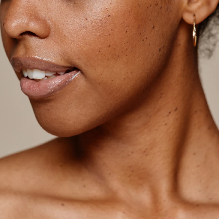 Oya Health Your Skin Tells a Story 2